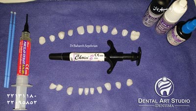 در پرسلن ونیر یا لمینیت ونیر مراحل لامینت دندان چگونه است؟