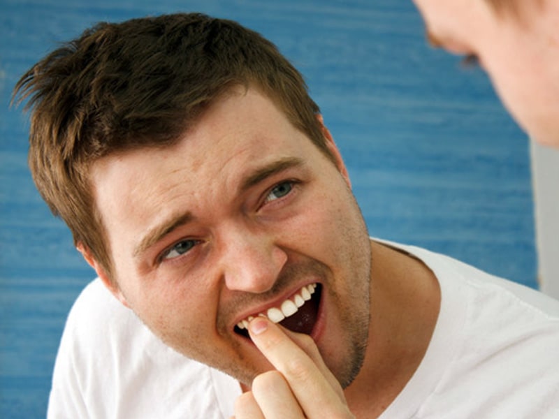 لق شدن دندان بعد از ارتودنسی