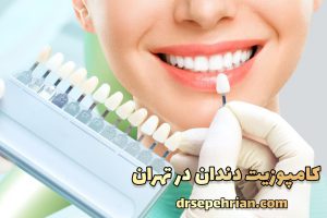 مراقبت های بعد از کامپوزیت ونیر | دکتر سپهریان