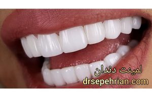 فرق کامپوزیت و لمینت چیست؟ | دکتر سپهریان